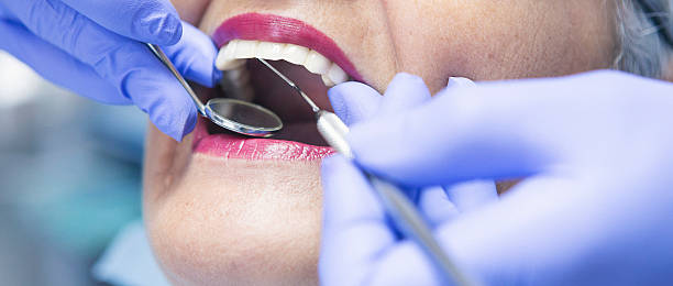 Best Emergency Broken Tooth Repair in Walnut Creek, OH
