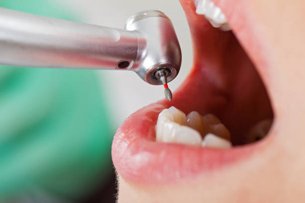 Best Emergency Dental Care for Trauma or Injury in Walnut Creek, OH